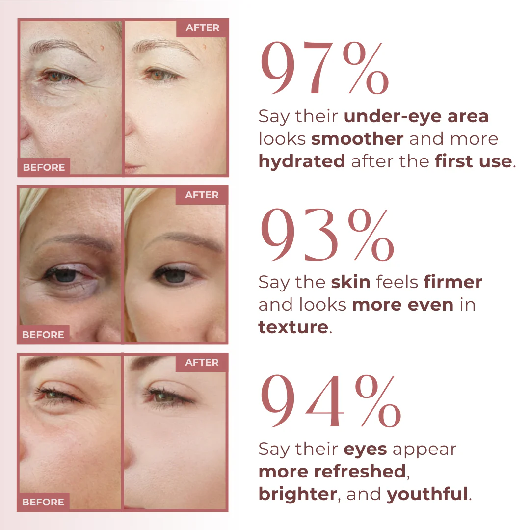 Bakuchiol Peptide Eye Repair - Image 2