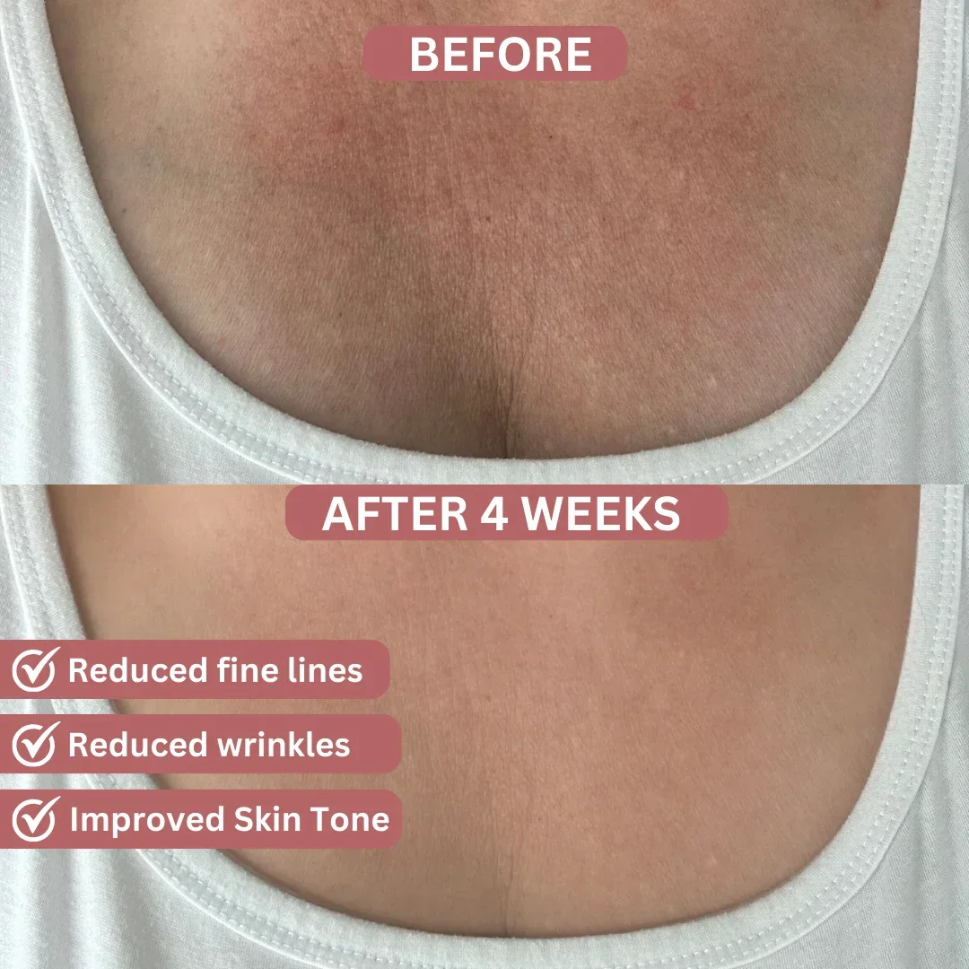 Bio-Collagen Chest Patches - Image 4