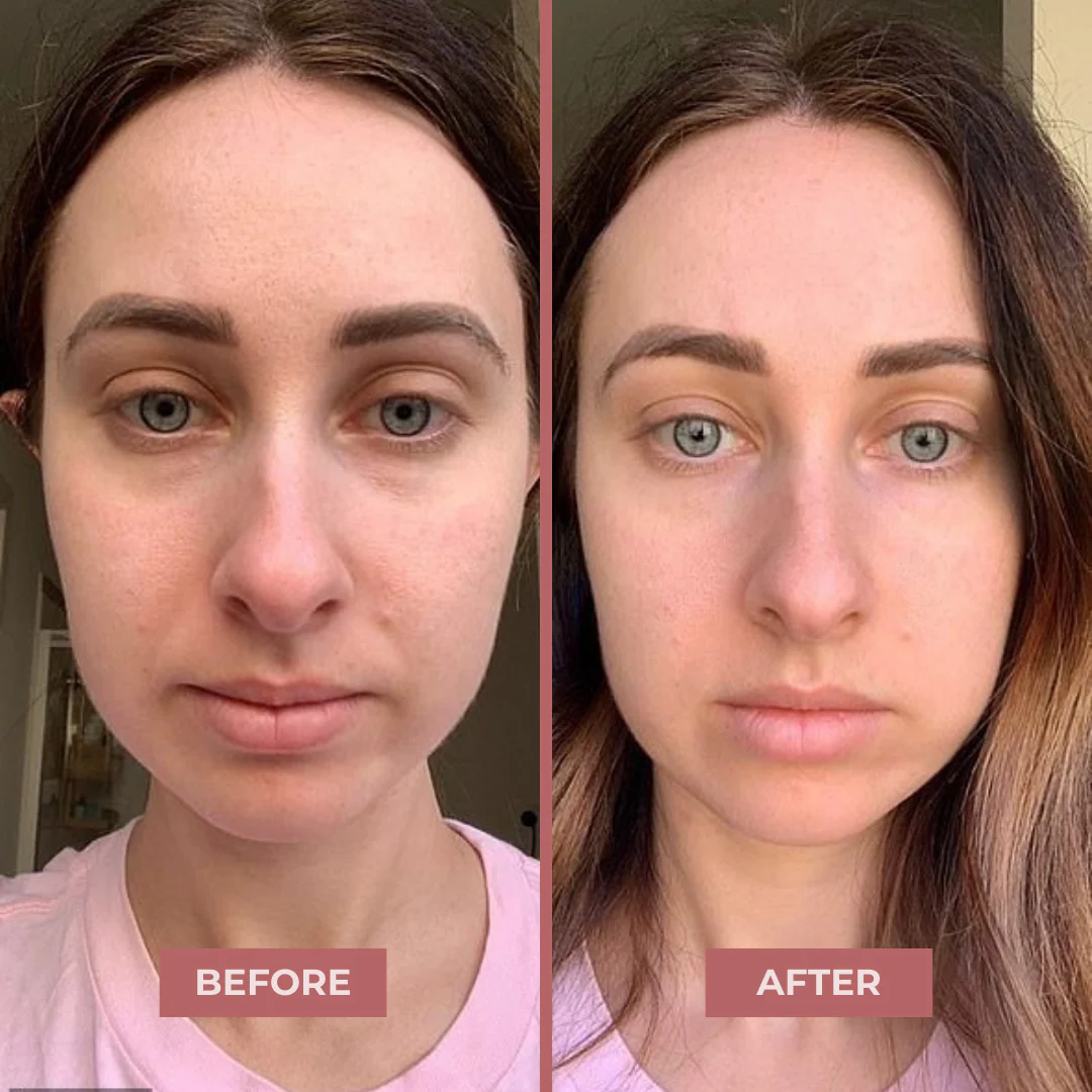 Bio-Collagen Eye Patches - Image 7