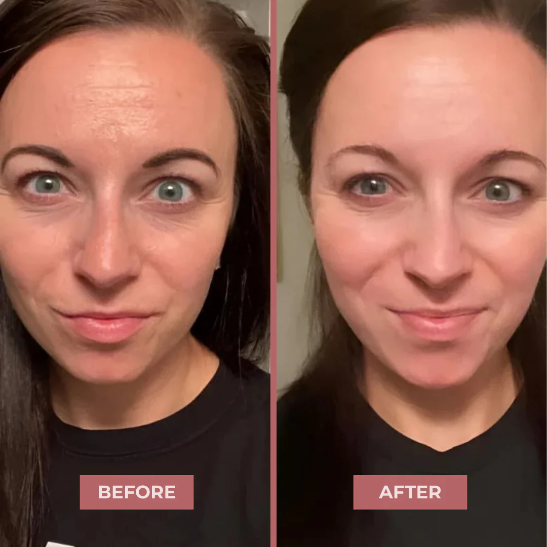 Bio-Collagen Mask - Image 8