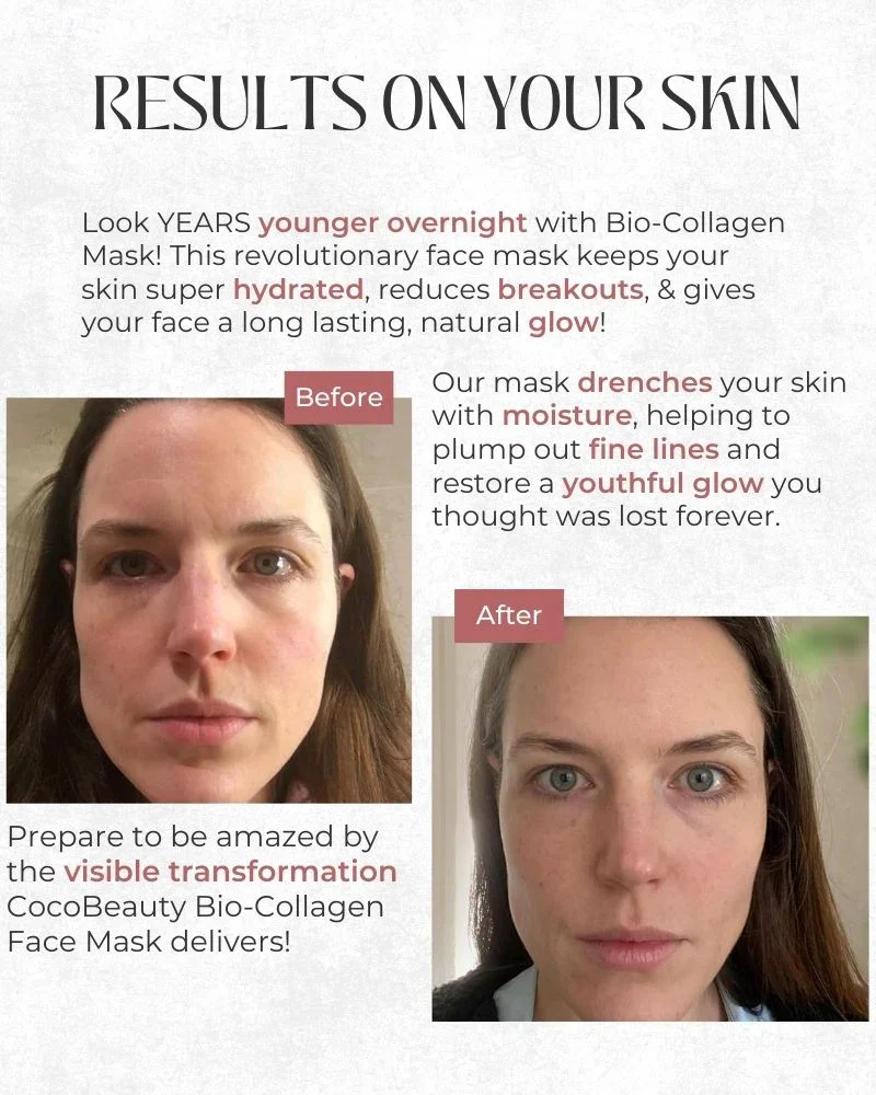 Bio-Collagen Mask [Bundle] - Image 14