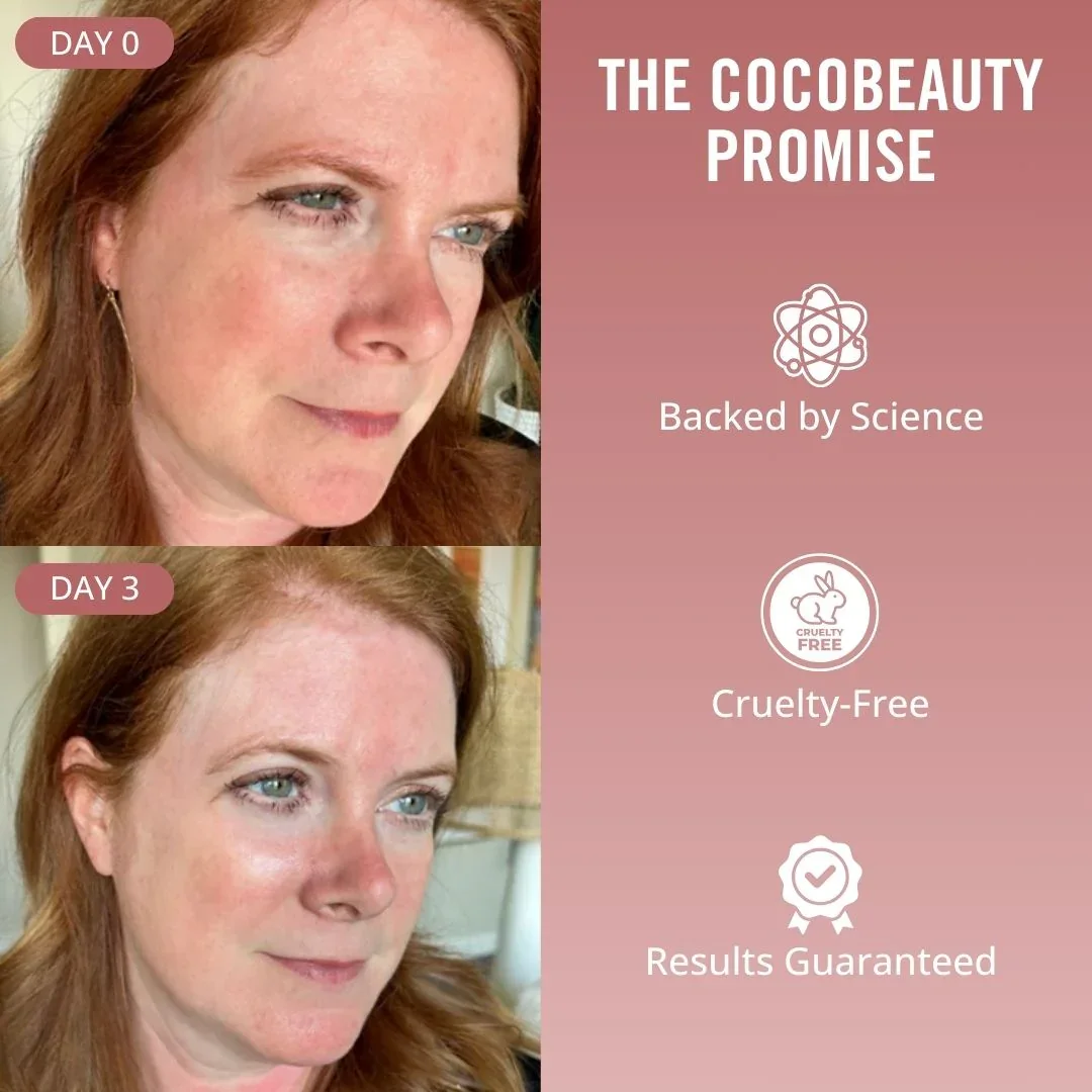 Hydrolyzed Collagen Boost 4 Weeks Treatment - Image 12
