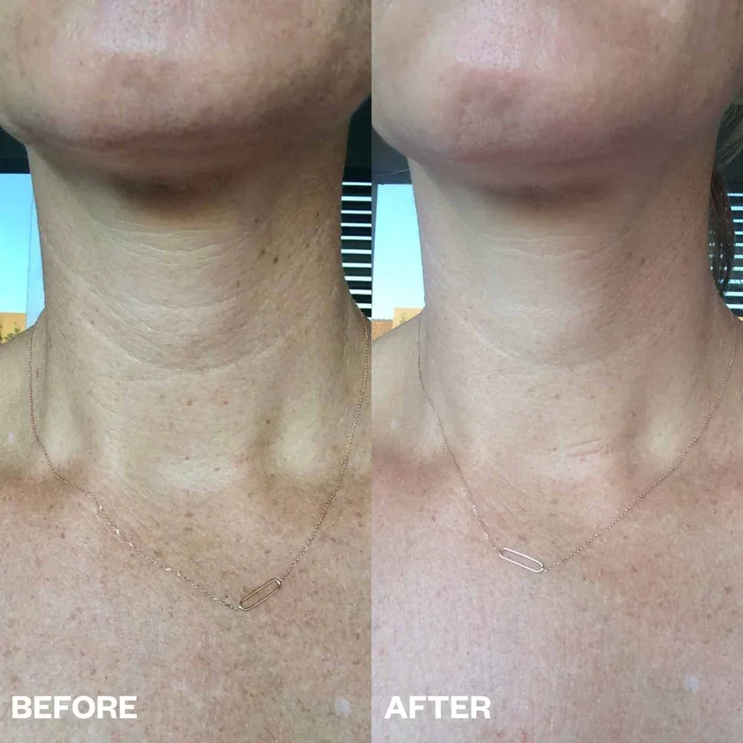 Bio-Collagen Neck Patches - Image 11