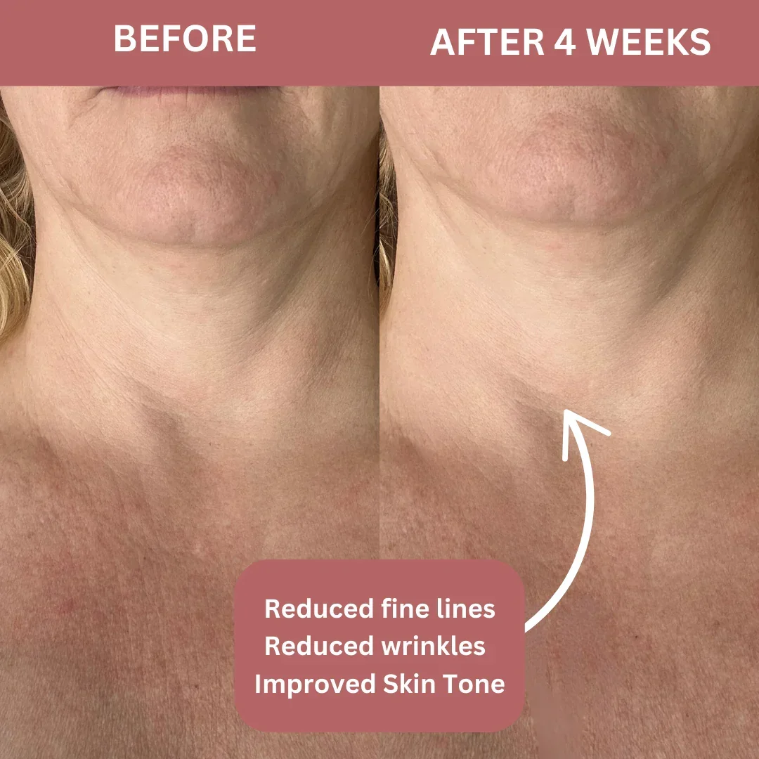 Bio-Collagen Neck Patches - Image 9