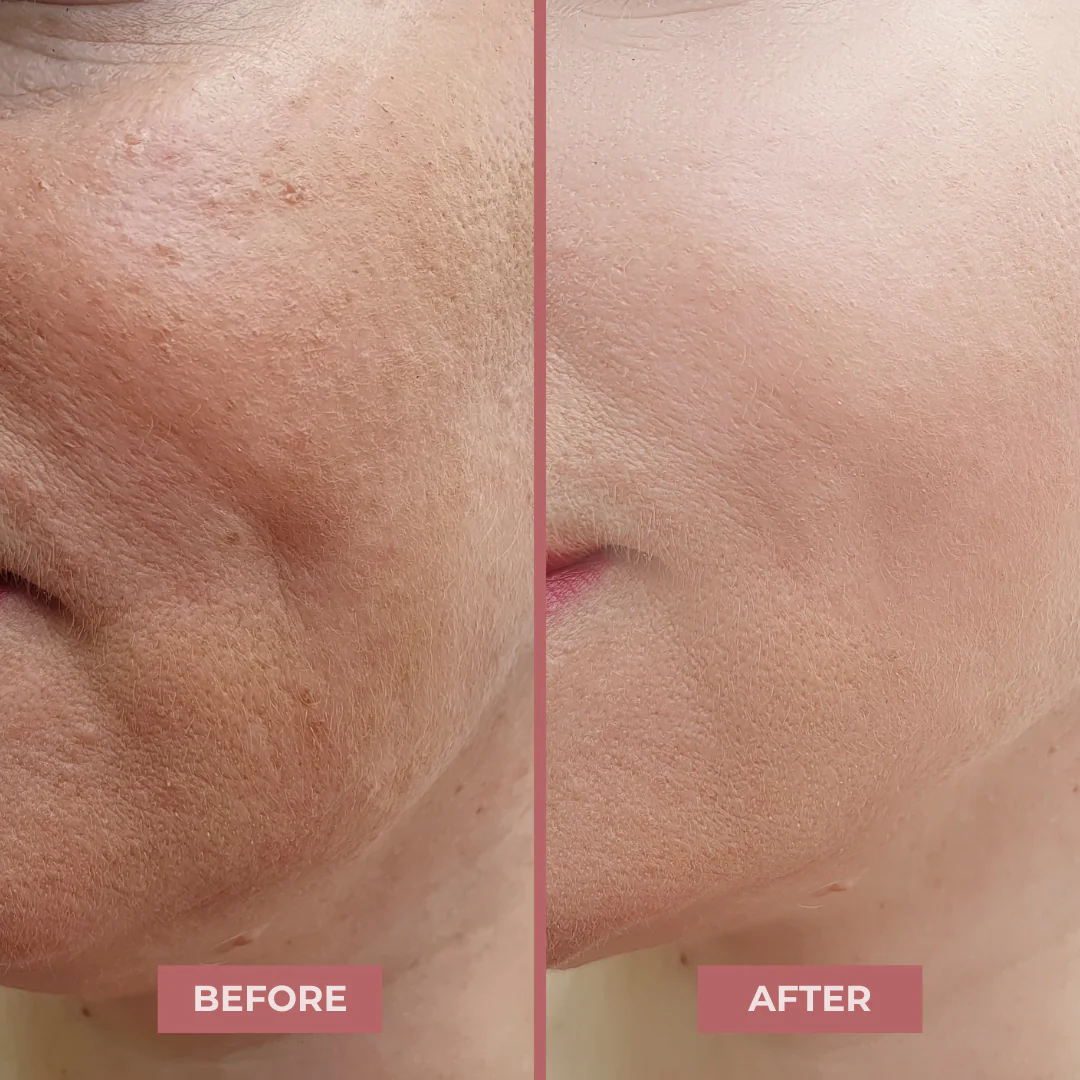 BioLift NAD+ - Peptide Serum by CocoBeauty - Image 7