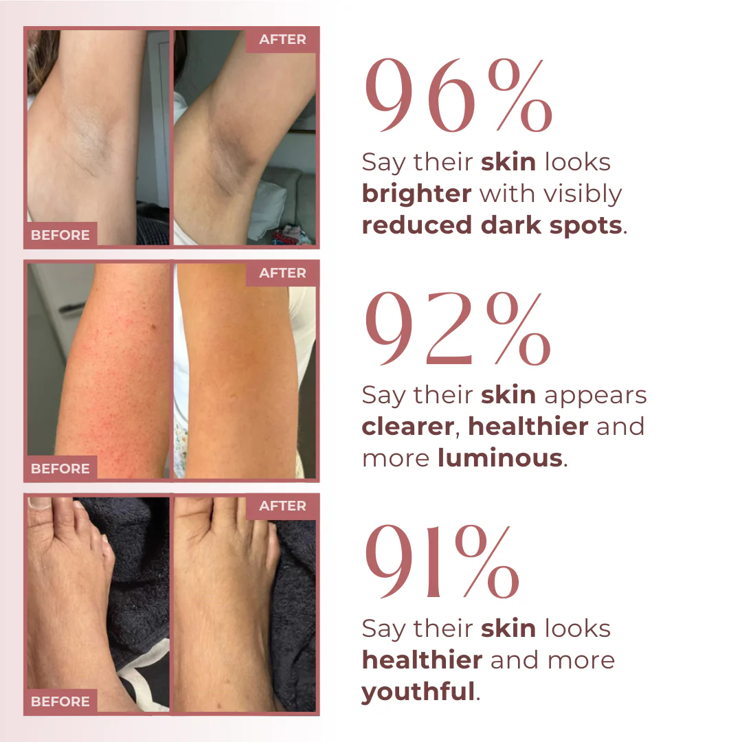 Body Peel Spray - Kojic + Turmeric - Image 2