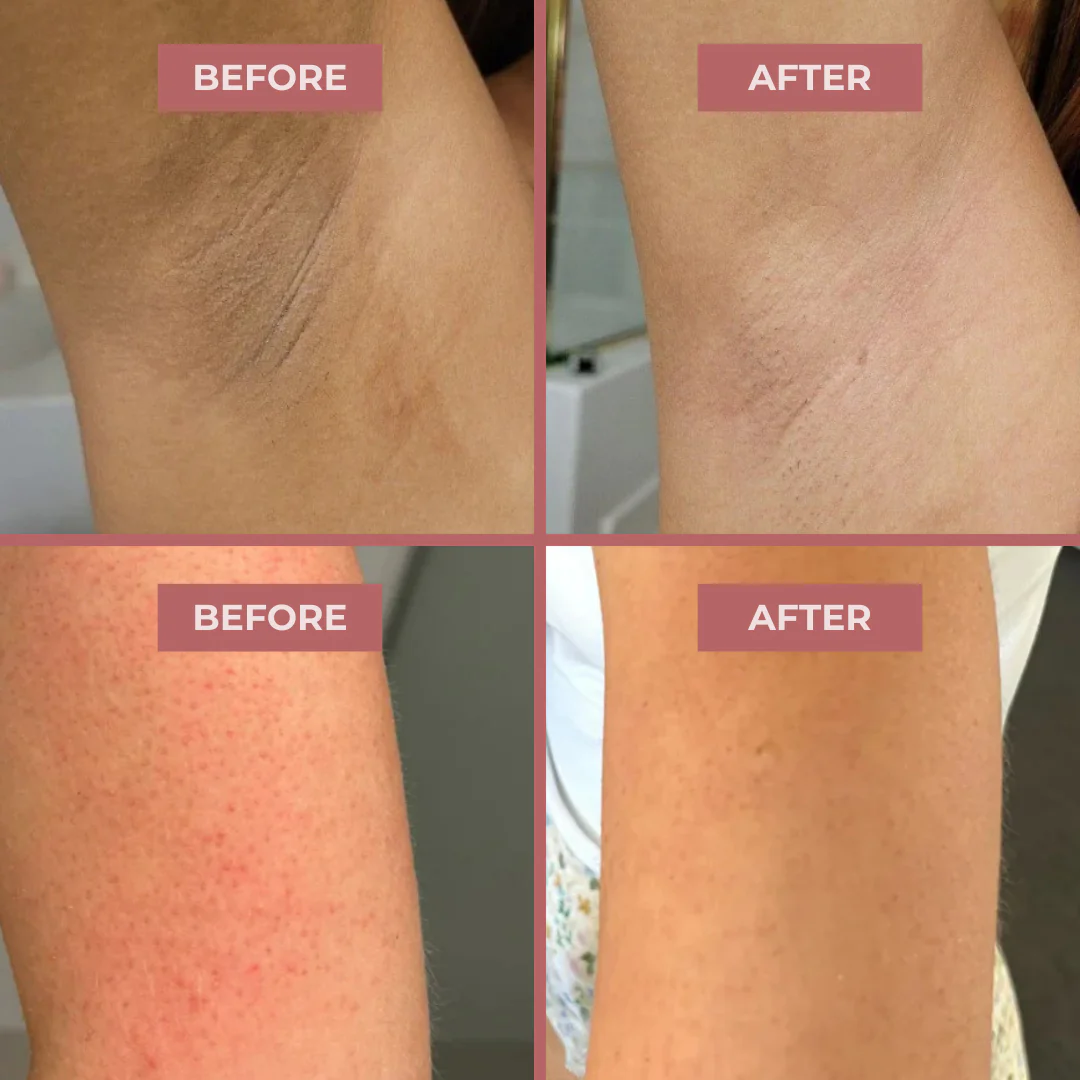 Body Peel Spray - Kojic + Turmeric - Image 6