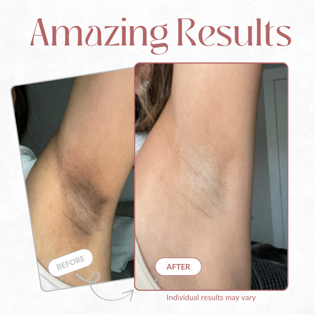 Peel Shot - Kojic + Turmeric Body Peel Spray - Image 4