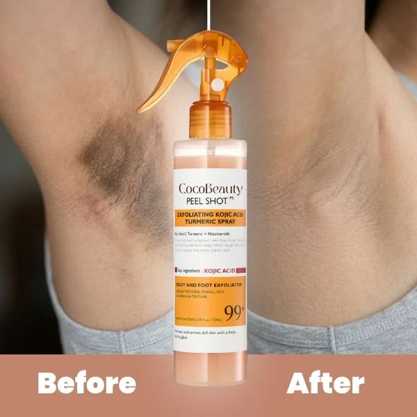 CocoBeauty - Body Peel Spray with Kojic + Turmeric - Image 4