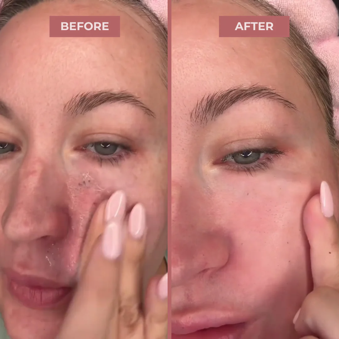 CocoBeauty Peel Shot Glow Rice Ampoule - Image 7