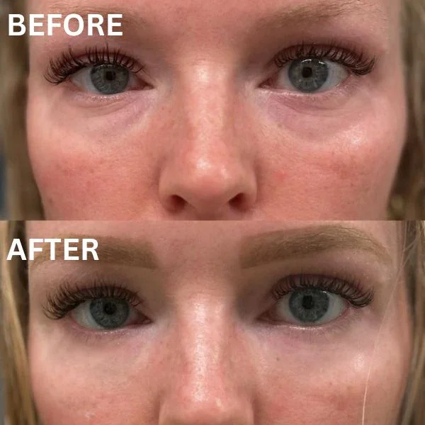 InstantFirm Collagen Eye Patches - Image 13