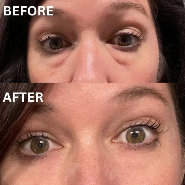 InstantFirm Collagen Eye Patches - Image 14