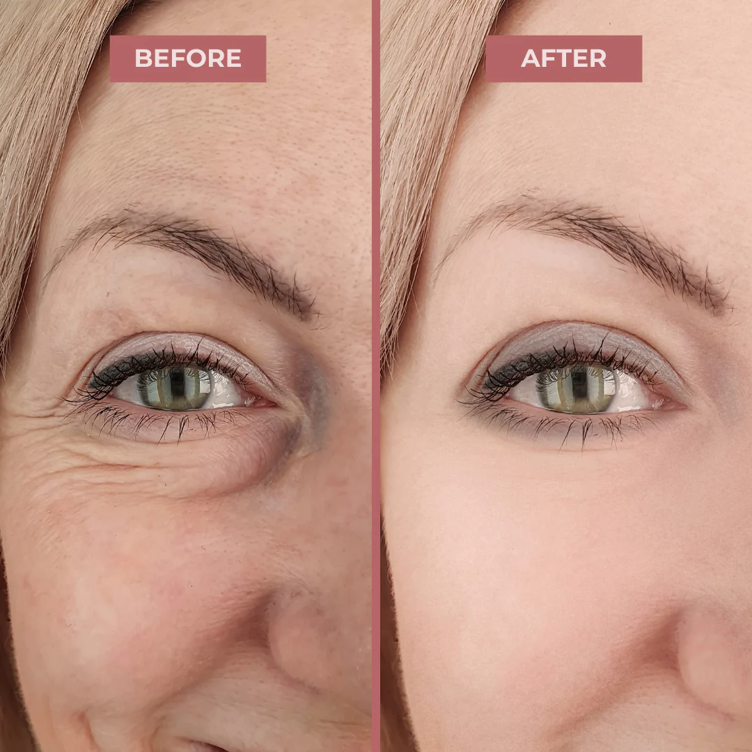 InstantFirm - Collagen Eye Patches - Image 7