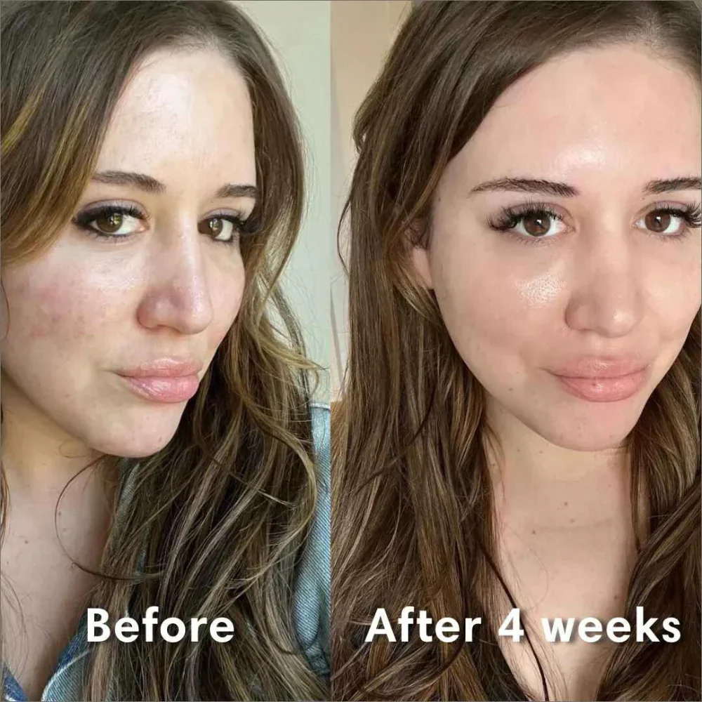 LAST MINUTE SALE - Bio-Collagen Masks - Image 8