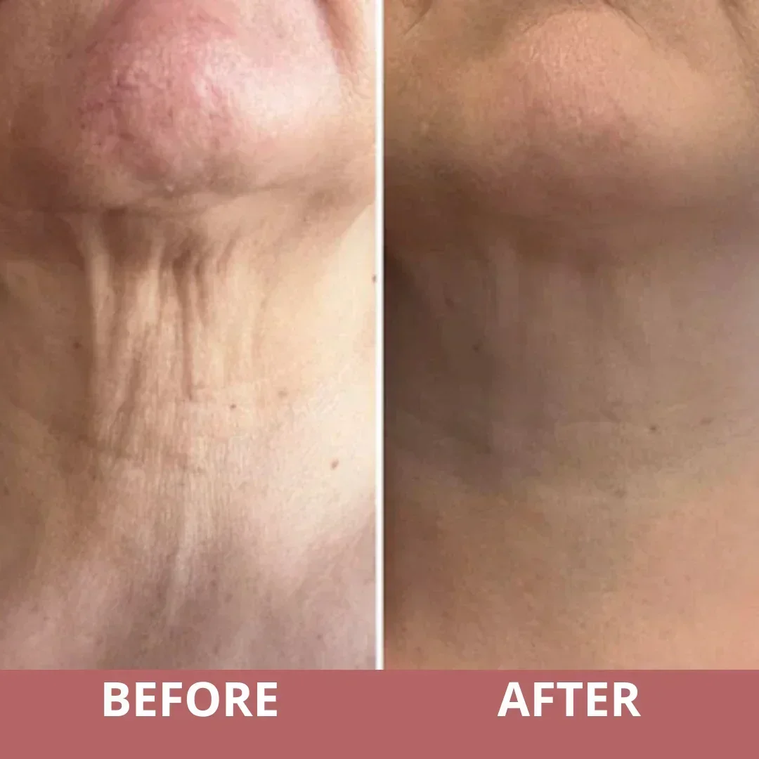 Neck Sculpt Firming Cream – Tighten, Lift & Restore Youthful Skin - Image 3